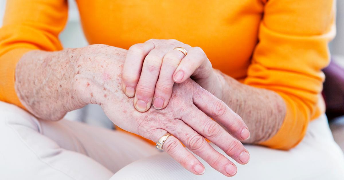 Unterschied zwischen Arthrose und Arthritis