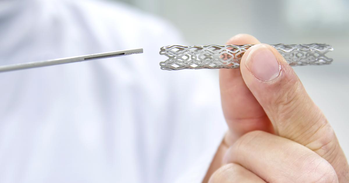 Was ist ein Stent? Wie verläuft eine StentOP?