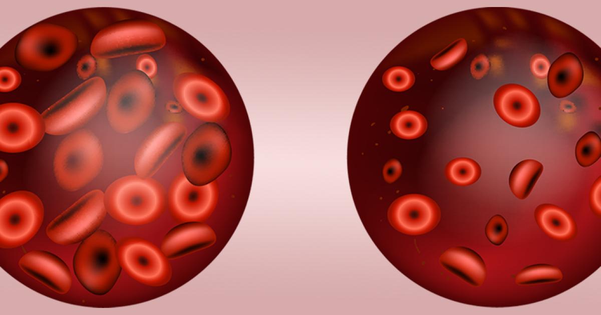 Anämie Symptome und Ursachen