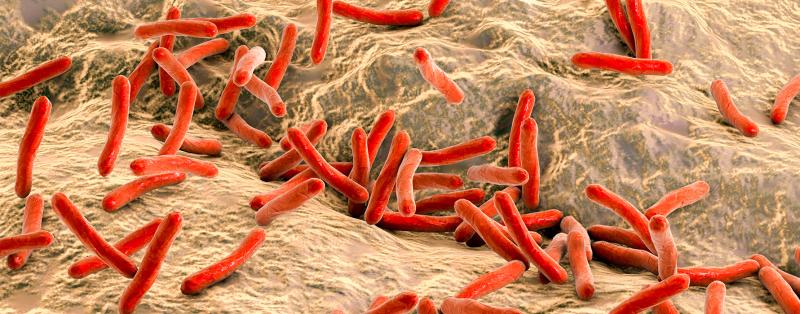 Lepra: Ursache ist das Bakterium Mykobakterium leprae