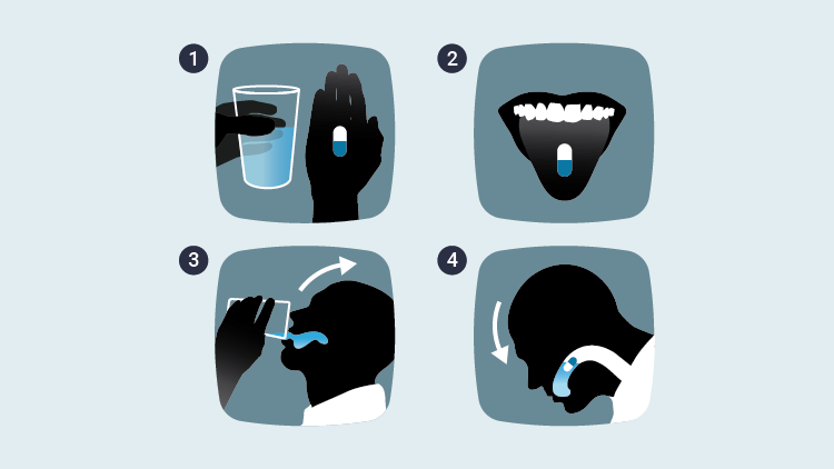 Kapseln schlucken leicht gemacht Illustration: Kapseln schlucken leicht gemacht